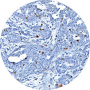 Rankin IHC control slides for BRCA 1, stained and unstained consumables for immunohistochemistry testing.