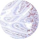 Rankin IHC Control Slides with BrdU staining, unstained and stained samples for immunohistochemistry testing.