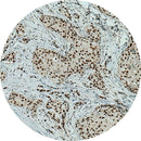 Control slides for IHC testing of BRG1/SMARCA4, Rankin brand, showing unstained and stained tissue samples for laboratory analysis.