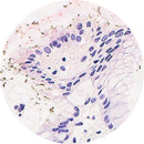 Rankin IHC H. pylori control slides, consumables with unstained and stained samples for laboratory testing and quality control.