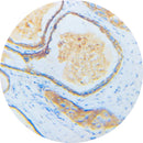 Rankin IHC Control Slides for Her2, 4 tissue samples, unstained and stained tissue sections for laboratory testing.