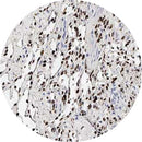 Rankin Control Slides for IHC HHV8 testing, includes unstained and stained slides for laboratory diagnostic use.