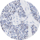 Rankin HPV high-risk IHC control slides, unstained and stained consumables for immunohistochemistry testing.