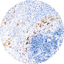 Rankin IHC control slides for HSV Type 1, showing unstained and stained samples for immunohistochemistry testing.