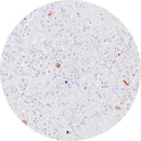 Unstained and stained control slides for IHC testing of HSV Type 2 herpes simplex virus, branded Rankin consumables.