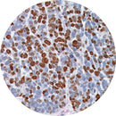 Rankin IHC control slides for Ki-67, unstained and stained consumables used for immunohistochemistry testing.