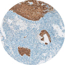 Rankin Control Slides for IHC P16, unstained and stained consumables for immunohistochemistry testing.