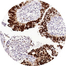 Rankin IHC control slides featuring unstained and P53-stained samples for immunohistochemistry testing.