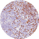Unstained and stained control slides for IHC-TdT, Rankin brand, used as consumables for laboratory testing and quality control.