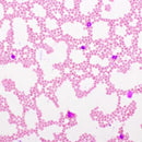 Hematology stain pack by Rankin with Wright-Giemsa stain for blood sample analysis, displayed in the image.
