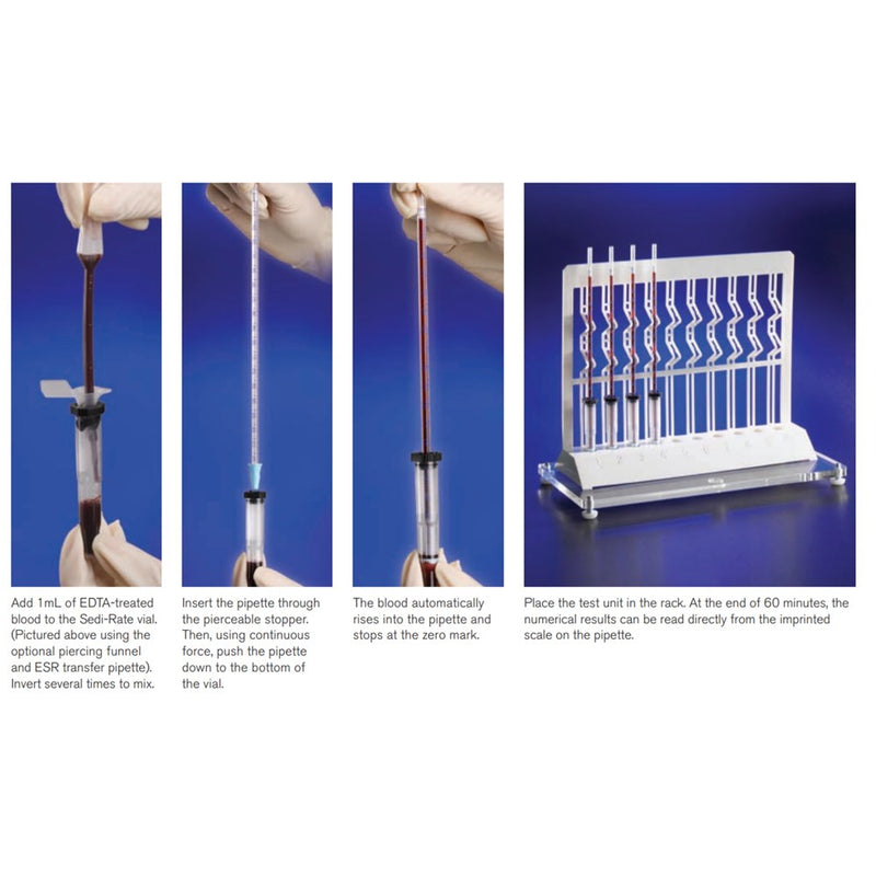 Sed Rate Kit Erythrocyte Sedimentation Rate (ESR) Tubes | Rankin Biomedical