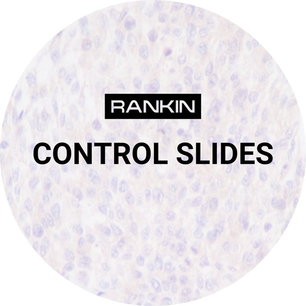 Control Slides, IHC - Total RB 3C8